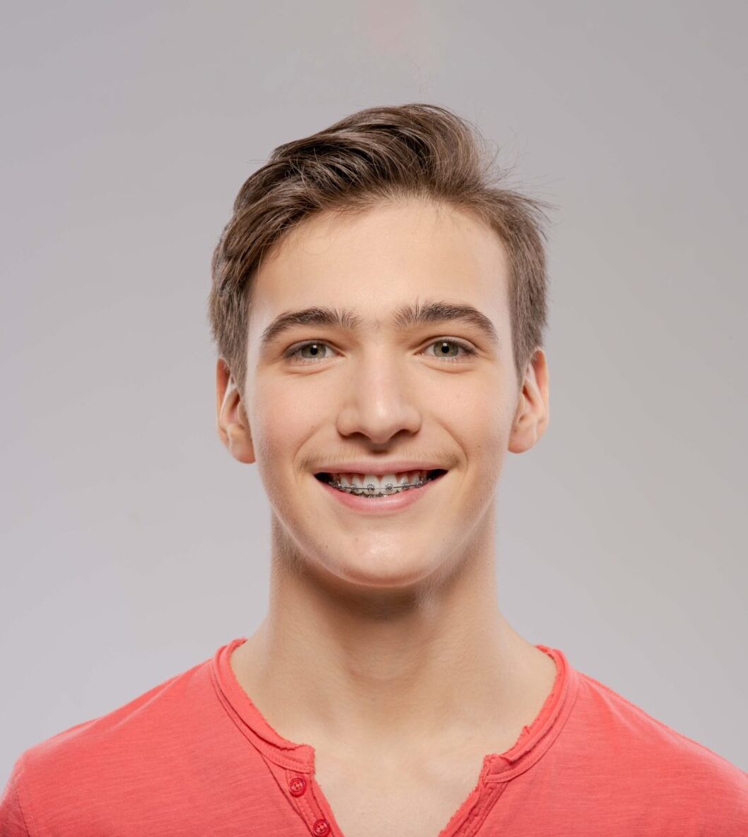 Adolescent orthodontic treatment