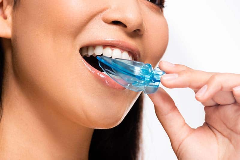 Mouthguards