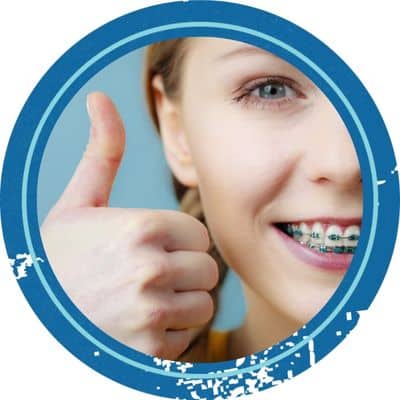 Braces
